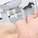 인천턱프팅 잘하는 소유뷰티랩 솔직후기
