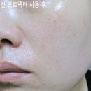 피에프케이 이미지