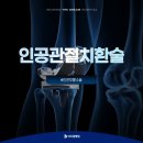 인천더드림병원 | 인천무릎수술 시기, 인공관절치환술 언제 해야 할까