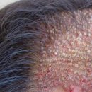 청담인플라 이미지