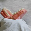 포셀트치과의원 네이버블로그