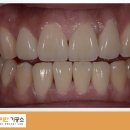 다이안치과기공소 이미지