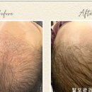 차오름 scalp & skin