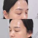 퇴계커텐 | 춘천피부관리 더맑은스킨 퇴계점 저자극필링후기