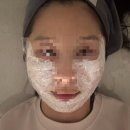 데이뷰의원광주상무점 | 데이뷰의원광주상무점)리쥬란힐러 2cc 나비존 맞은 내돈내산후기