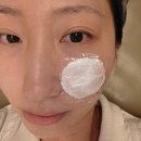 기마킨결혼정보 | 수원 여드름흉터 새살침 1회차 솔직 후기 패인 흉터 결혼준비 예신관리 프락셀 부작용