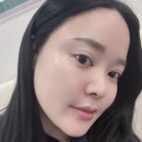 대도한의원 | 안양피부과 여드름자국 모공 잔주름 치료 한의원 어붐야그 레이저 효과 가격 후기