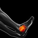 뿌리마취통증의학과의원 이미지