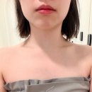 바디채널 상무점 | 광주에스테틱 상무지구피부관리 끌리메 광주점 작은얼굴 관리 찐후기 / 비대칭 비포 애프터 있음