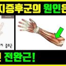 방아쇠수지증후군 통증 원인 증상 치료 손마사지 이미지