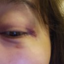 해피한 멍 이미지