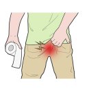 시흥대로1L | 치질 초기 증상과 원인 – 언제 의료기관을 찾아야 할까요? (구로디지털단지역 한의원)