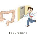 자극성 장 증후군(Irritable bowel syndrome) 이미지