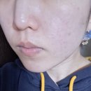 와이제이마켓 | 운정 피부관리 샵 콜드플라즈마 전문, 와이제이뷰티에 가보았다 _283 page