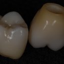 민치아치과기공소 이미지