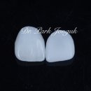 아카데미치과기공소 이미지