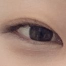 쌍수 병원 발품기 上