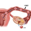 다나산부인과의원 | (26/7/8) 나팔관 조영술 후기