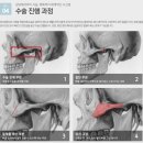 비엔성형외과의원 이미지