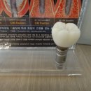 서울더믿음치과 네이버블로그