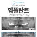 림플란트치과의원 네이버블로그