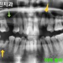 열린미소치과의원 이미지