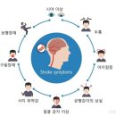 뇌졸중 (뇌경색, 뇌출혈) 이미지