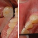 림플란트치과의원 이미지