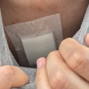 관해로 | 소포성림프종 거대미만성b세포 항암 관령 정보 및 관해판정후 항암포트제거 시술 받은 후기 회사복귀 완료