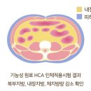 투비 티스토리