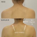 이진쵸이스