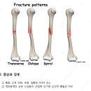 [어깨손상] Humerus Fracture : 상완골 골절 이미지