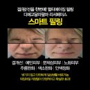 스마트필 이미지