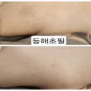 B&B에스테틱 네이버블로그