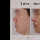 닥터뉴셀의원 | [강남 피부과 피부 피부관리] 닥터뉴셀의원 강남본점 닥터뉴셀 강남본점, 맞춤 진료 보장