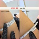 솔샘체형관리 네이버블로그