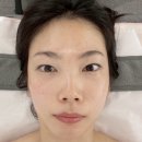 디엠브로우 | 양천향교 수기관리 오렌지브로우 하이푸리프팅 후기