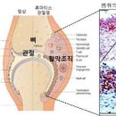 류마티스 관절염 원인 손가락 무릎 이미지