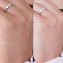 20-A | 💍 결혼준비 20. 소솜브라이드 토탈 A 촬영 보정본 수령 후기