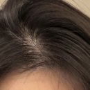 헤어온의원 이미지