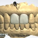 바른이 치과기공소 이미지