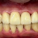 부여치과기공소 이미지