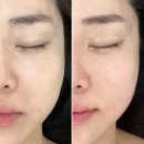 제이메디케어 | 울산피부관리 잘하는 제이콤마 피부앤왁싱