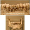 4000년 전 이집트의 치아 브릿지 시술.jpg 이미지