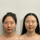 스타벅스 부천옥길DT점 | 부천 옥길 결혼준비 전 윤곽관리 제이알테라피 추천