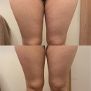 채움테라피 네이버블로그