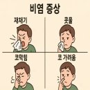 제이앤씨파트너스모든머리 | 비염, 방치하면 축농증,기관지염까지? 생존 꿀팁과 현실 후기