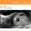 (주)한결그린 | 인천 서구 그린산부인과의원에서임신확인서 받았어요!(5주~6주👶🏻🫶🏻)