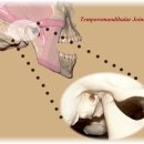 우리전통수기치료법 - 턱관절(TMJ, temporomandibular joint)이상 이미지