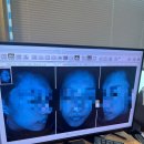 아름다운피부과의원 | [건대피부과,광진구 피부과] 포텐자 후기